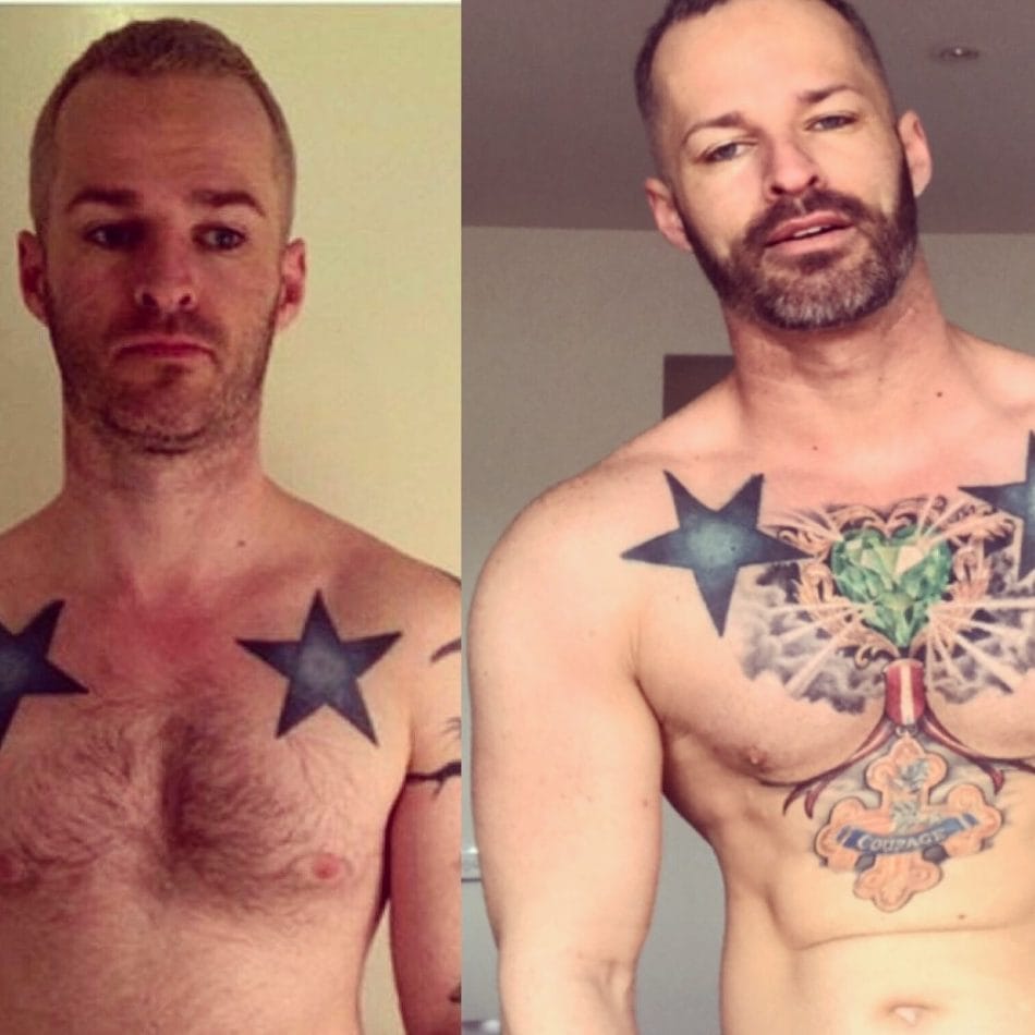 Image-conscious men push rise in 'Brotox'