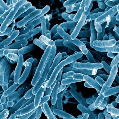 Urgent answers needed on tuberculosis, experts say