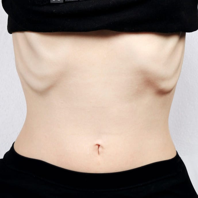 Super-skinny fashion laws a step in the right direction, but not enough