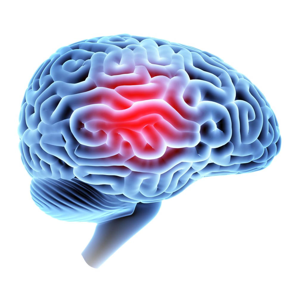 Head injury woes spark calls for change post image