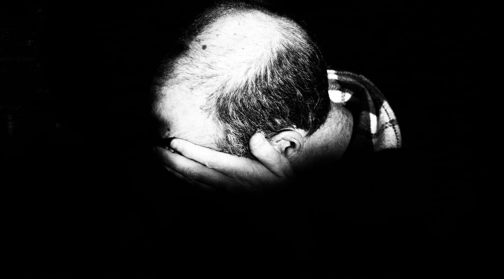 To thin or try to win? Untold distress as young men battle hair loss post image