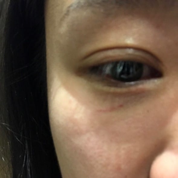 International student injured during racial attack post image