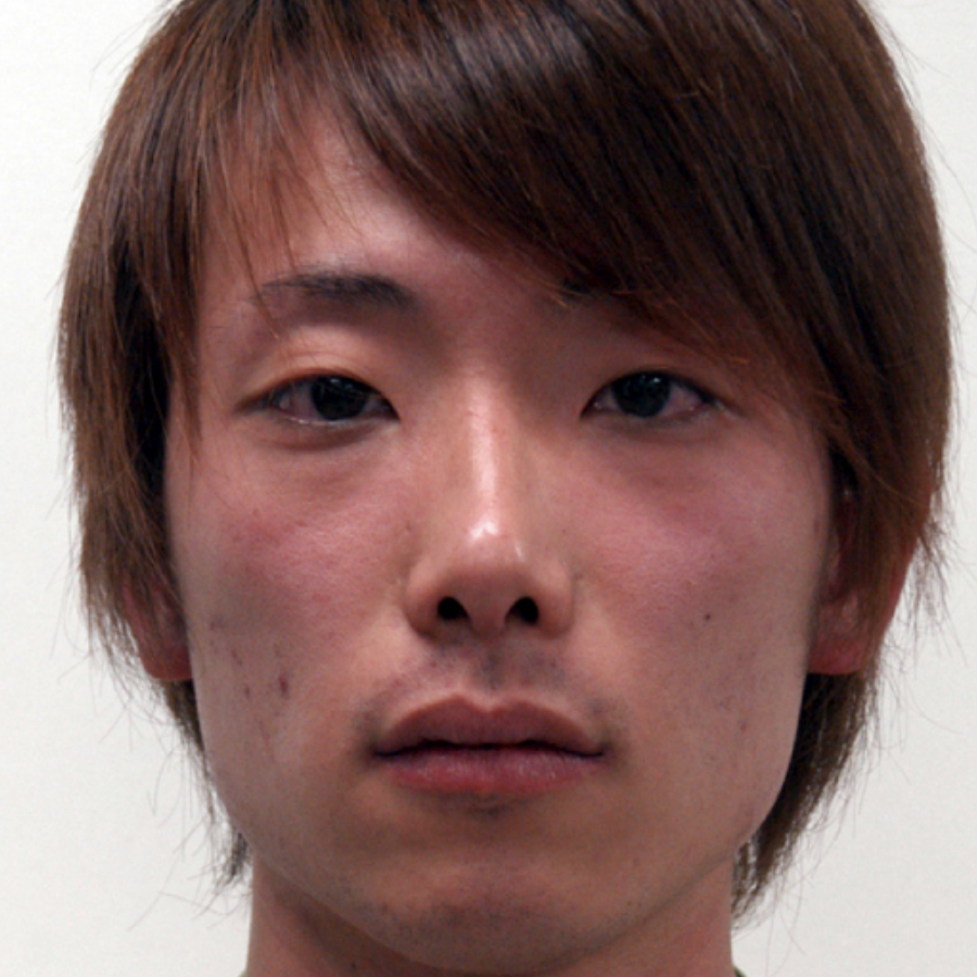 Asian flush sufferers using Zantac at potential risk post image