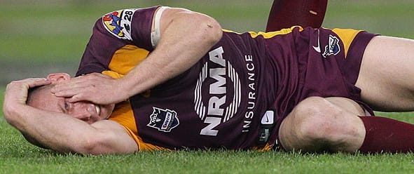 Concussion a blow to sport post image