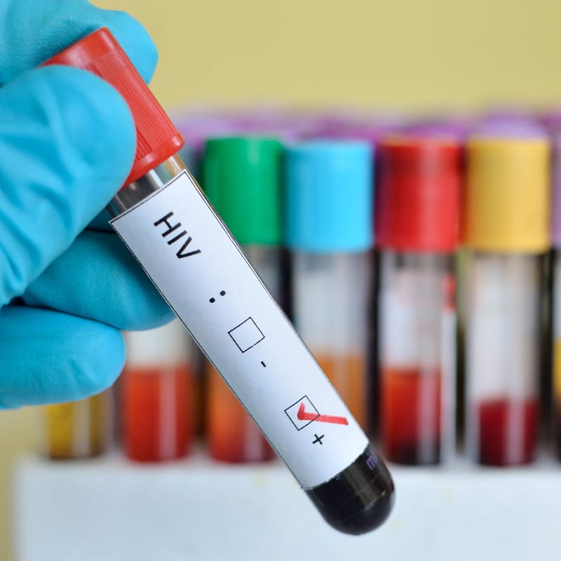 An end to AIDS in Australia post image