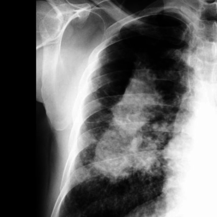 Stylish kitchen renovations put stonemason’s health at risk post image