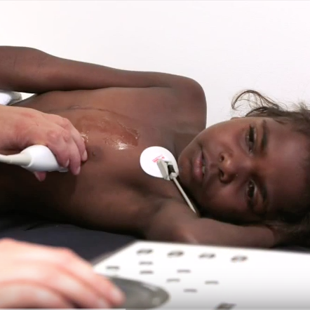 Rheumatic fever rife in indigenous communities as nation-wide rates spike post image